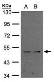 Anti-IFRD1 antibody used in Western Blot (WB). GTX104578