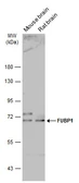 Anti-FUBP1 antibody used in Western Blot (WB). GTX104579