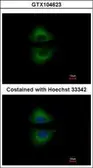 Anti-GRAP antibody [C2C3], C-term used in Immunocytochemistry/ Immunofluorescence (ICC/IF). GTX104623