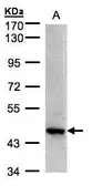 Anti-Bif-1 antibody [C2C3], C-term used in Western Blot (WB). GTX104636