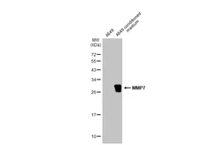 Anti-MMP7 antibody [C2C3], C-term used in Western Blot (WB). GTX104658