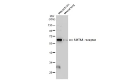 Anti-5-HT1A receptor antibody [N3C1], Internal used in Western Blot (WB). GTX104703