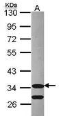 Anti-CDK3 antibody [N1C2] used in Western Blot (WB). GTX105047