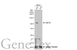 Anti-OCT1 antibody used in Western Blot (WB). GTX105202