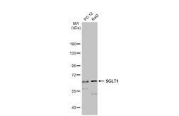 Anti-SGLT1 antibody [N3C3] used in Western Blot (WB). GTX105367