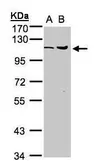 Anti-USP5 antibody [C1C3] used in Western Blot (WB). GTX105407
