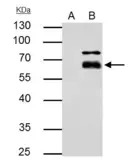 Anti-MMP8 antibody used in Immunoprecipitation (IP). GTX105428
