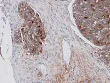 Anti-Mesothelin antibody [N1C2] used in IHC (Paraffin sections) (IHC-P). GTX105471