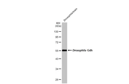 Anti-GLUD1 + GLUD2 antibody used in Western Blot (WB). GTX105765