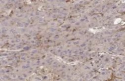 Anti-Folate Receptor beta antibody used in IHC (Paraffin sections) (IHC-P). GTX105822