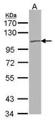 Anti-KCNQ5 antibody [N3C2], Internal used in Western Blot (WB). GTX106198