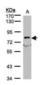 Anti-SHKBP1 antibody [N2C2], Internal used in Western Blot (WB). GTX106252