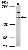 Anti-USP47 antibody used in Western Blot (WB). GTX106253