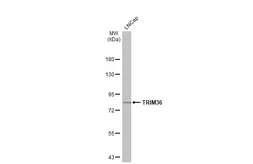 Anti-TRIM36 antibody [C3], C-term used in Western Blot (WB). GTX106290