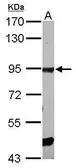 Anti-ELMO1 antibody [C3], C-term used in Western Blot (WB). GTX106301