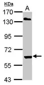 Anti-ARIH2 antibody [C3], C-term used in Western Blot (WB). GTX106404