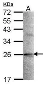 Anti-STMN2 antibody used in Western Blot (WB). GTX106422