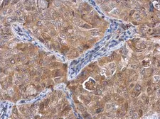 Anti-ACTL8 antibody used in IHC (Paraffin sections) (IHC-P). GTX106696