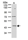 Anti-Cdk15 antibody [N1C3] used in Western Blot (WB). GTX107558