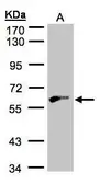 Anti-Glycerol kinase 2 antibody [N1C1-3] used in Western Blot (WB). GTX107563