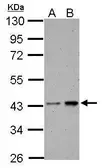 Anti-Casein Kinase 2 alpha antibody used in Western Blot (WB). GTX107576