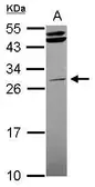 Anti-STK16 antibody [N1C3-2] used in Western Blot (WB). GTX107584