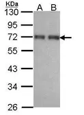 Anti-CCDC6 antibody used in Western Blot (WB). GTX107599