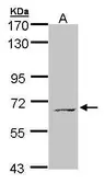 Anti-MPP3 antibody [N1C1] used in Western Blot (WB). GTX107608
