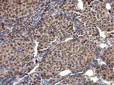 Anti-Selenophosphate synthetase 1 antibody [N1C1-2] used in IHC (Paraffin sections) (IHC-P). GTX107611