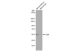 Anti-Lck antibody [N3C3] used in Western Blot (WB). GTX107785