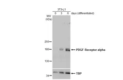Anti-PDGF Receptor alpha antibody [N2C2], Internal used in Western Blot (WB). GTX107903