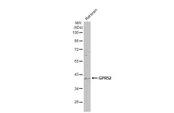 Anti-GPR52 antibody used in Western Blot (WB). GTX108123