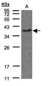 Anti-TXA2R antibody [N1], N-term used in Western Blot (WB). GTX108173