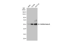 Anti-Inhibin beta A antibody used in Western Blot (WB). GTX108405