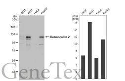 Anti-Desmocollin 2 antibody [C1C2], Internal used in Western Blot (WB). GTX108888