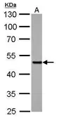 Anti-SMAD5 antibody used in Western Blot (WB). GTX108917
