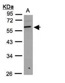 Anti-B3GNT3 antibody used in Western Blot (WB). GTX108928