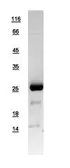 Human SNAP23 protein, His tag. GTX109089-pro