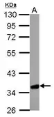 Anti-HMGCL antibody used in Western Blot (WB). GTX109096