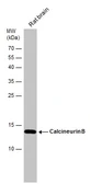 Anti-Calcineurin B antibody used in Western Blot (WB). GTX109127