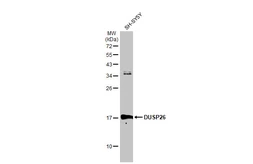 Anti-DUSP26 antibody [N1C1] used in Western Blot (WB). GTX109283