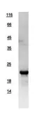 Human TTDN1 protein, His tag. GTX109301-pro