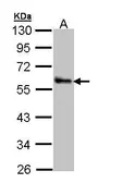 Anti-ZNF259 antibody [N3C3] used in Western Blot (WB). GTX109364