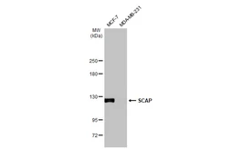 Anti-SCAP antibody [C2C3], C-term used in Western Blot (WB). GTX109474