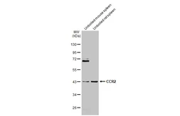 Anti-CCR2 antibody used in Western Blot (WB). GTX109684