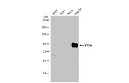 Anti-Villin antibody used in Western Blot (WB). GTX110034