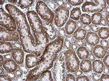 Anti-cIAP1 antibody used in IHC (Paraffin sections) (IHC-P). GTX110087