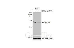 Anti-cIAP1 antibody used in Western Blot (WB). GTX110087