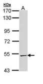 Anti-ALDH5A1 antibody [N1C1] used in Western Blot (WB). GTX110181