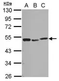 Anti-PSMC3 antibody used in Western Blot (WB). GTX110284